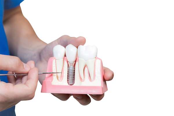 Can You Get Dental Implants if You Have Gum Disease from Joyful Dental Care in Chicago, IL