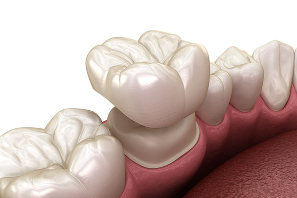 What Can Dental Crowns Do for Your Oral Health Issues? from Joyful Dental Care in Chicago, IL