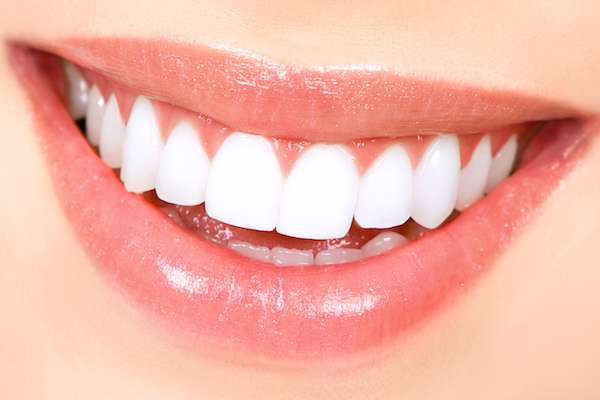 How Long Does Teeth Whitening Take from Joyful Dental Care in Chicago, IL