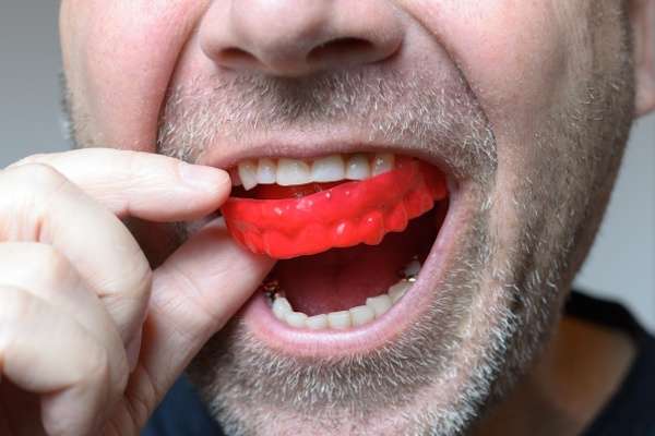 Save Your Teeth by Wearing Mouth Guards at Night from Joyful Dental Care in Chicago, IL