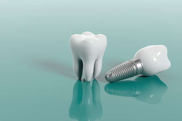 Multiple Teeth Replacement Options: One Implant for Two Teeth from Joyful Dental Care in Chicago, IL