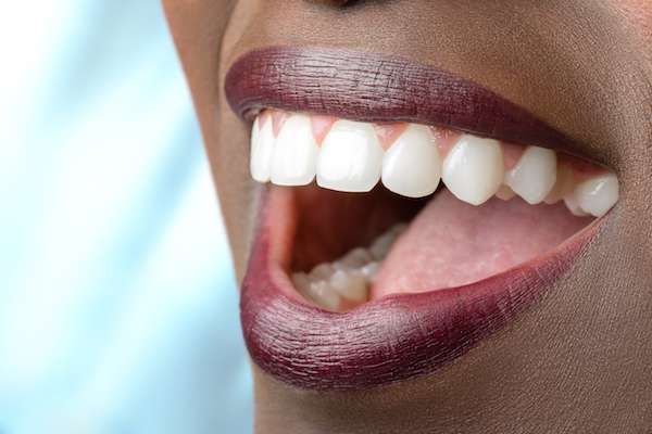 Routine Dental Care: What Are Tooth Colored Fillings from Joyful Dental Care in Chicago, IL